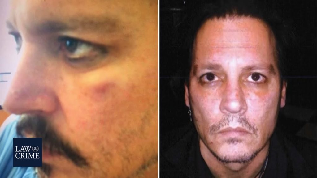 Photos of Johnny Depp's Injuries Presented in Court Today