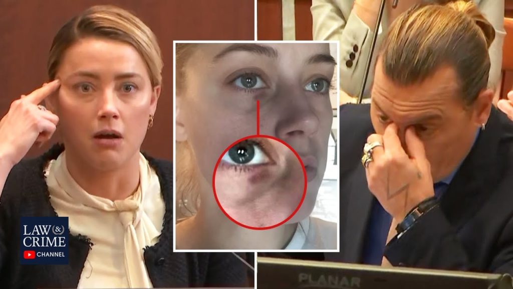 Photos Showing Injuries on Amber Heard Presented in Court on Thursday